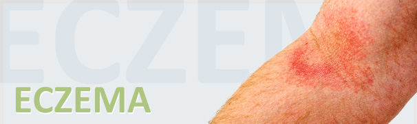Ringworm treatment | jock itch cream | Blue Star Ointment | Eczema Treatment | Eczema Cream