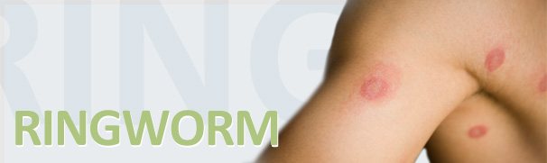 Ringworm Treatment - Blue Star Ointment